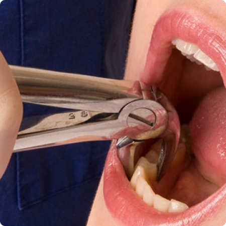 Stomatološke Usluge Oralna hirurgija